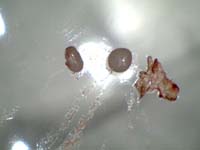 aug 29 2011 1 eggs from arm